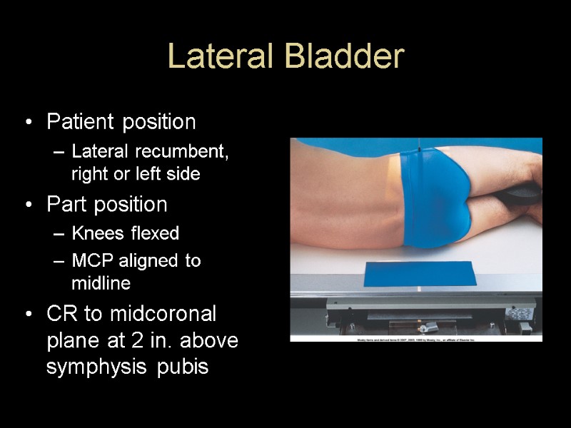 Lateral Bladder Patient position Lateral recumbent, right or left side Part position Knees flexed